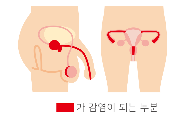 クラミジア感せん症で感せんする場所